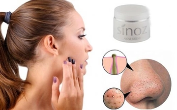 Sinoz Akne Kremi Kullanımı ve Faydaları Nelerdir?