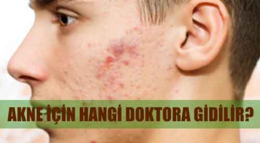 Sivilce Akne Tedavisi